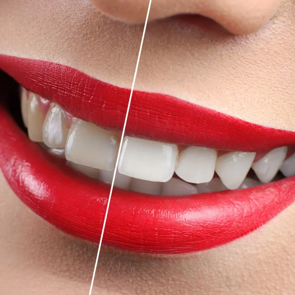 general dentistry at bion clinic by Dr. Nathan Vermaak keeps smiles and teeth amazing